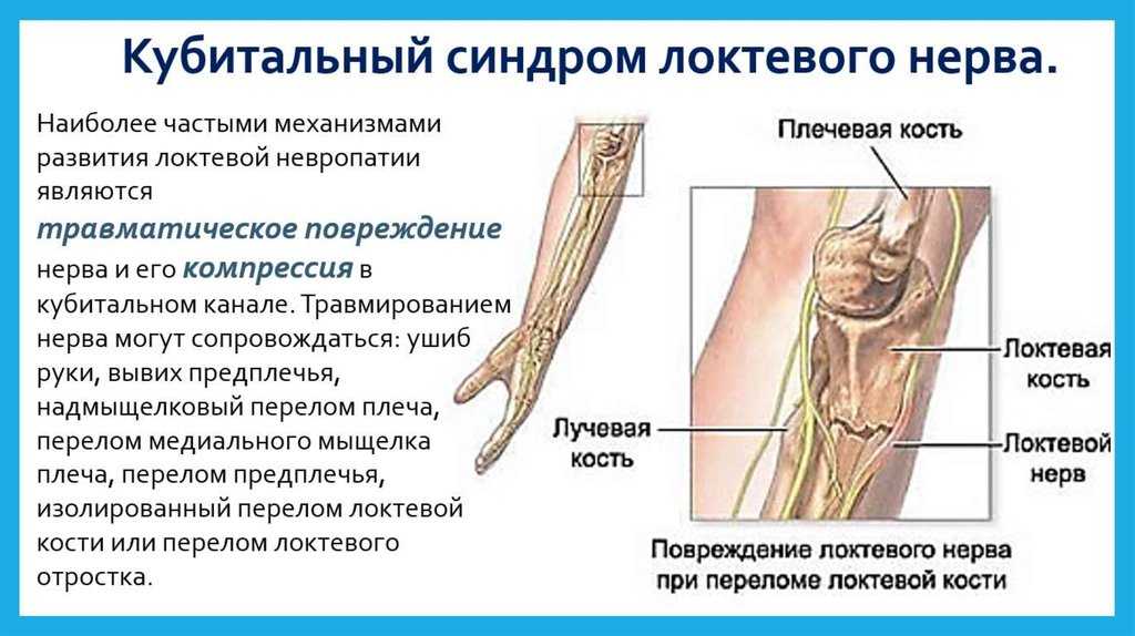 Спортивная травма коленного сустава