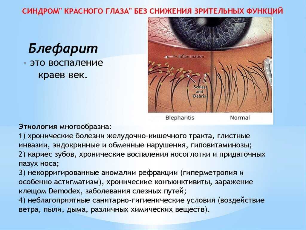 Что делать и чем лечить, если у вашего хомяка опухают или гноятся глаза