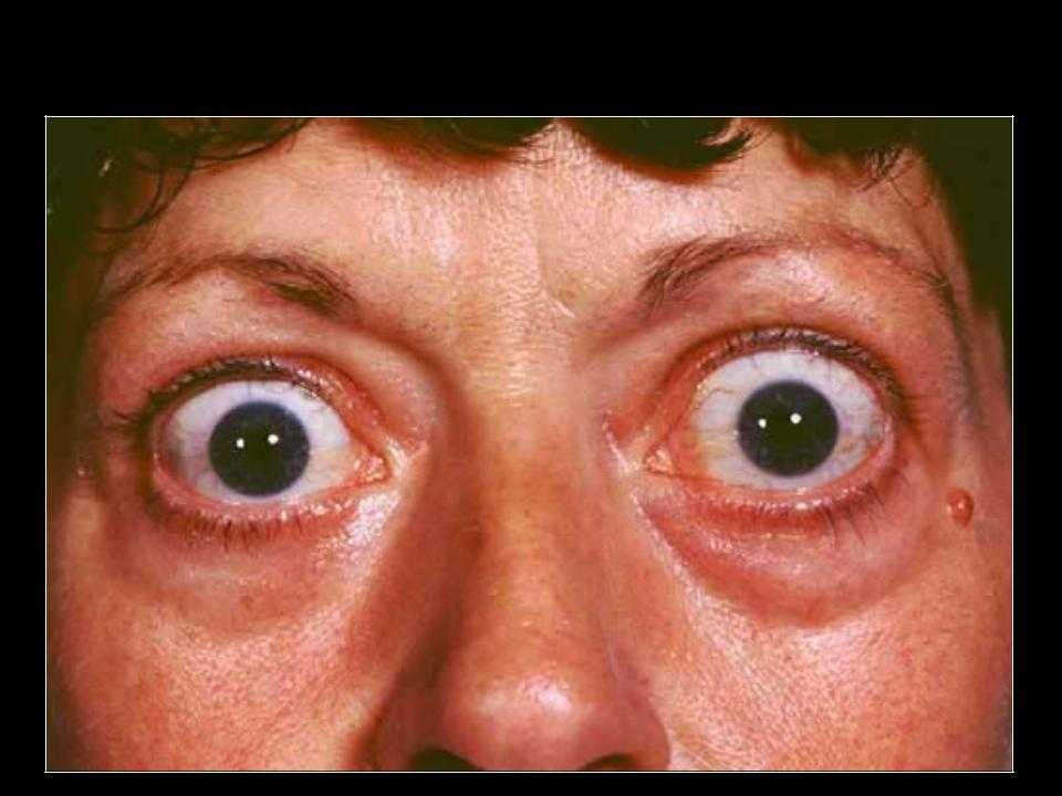 Глазные болезни у хомяков