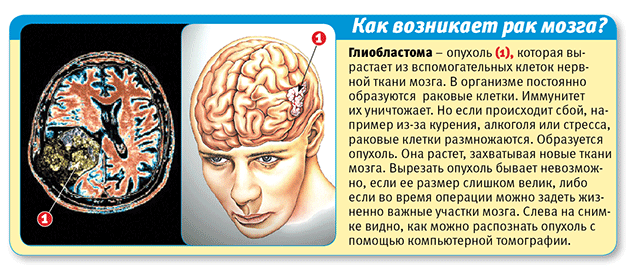 Диагностика и лечение заболеваний головного мозга