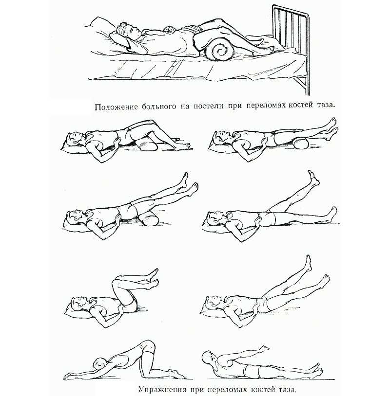 Реабилитация при переломах позвоночника (искусственная коррекция движений и др.)