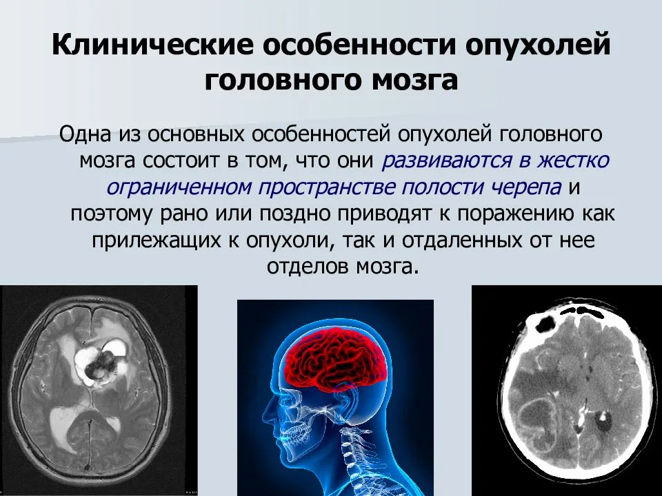 Опухоли головного мозга у собак: причины, симптоматика, методы лечения | блог ветклиники "беланта"