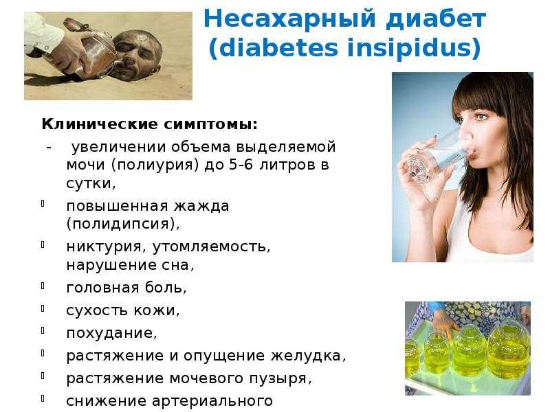 Несахарный диабет у собак